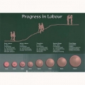 PROGRESS IN LABOUR CHART